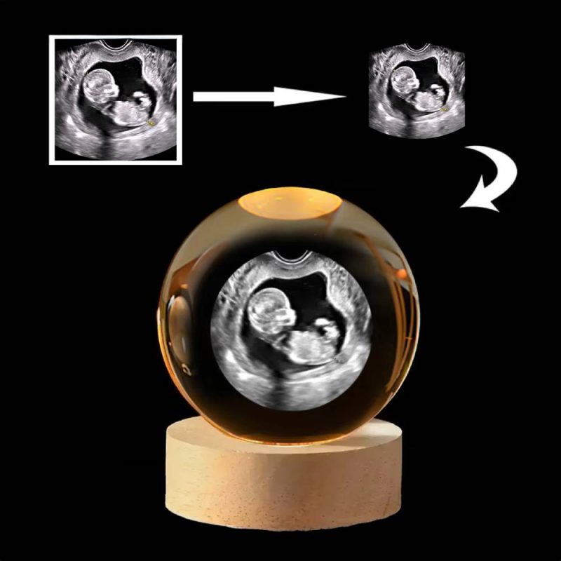 Customized B-Ultrasound Photo 3D Crystal Ball Hold Baby’s First Ultrasound Memories